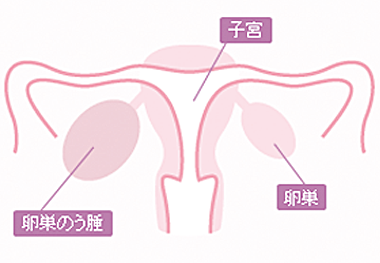 卵巣嚢腫 四谷メディカルキューブ